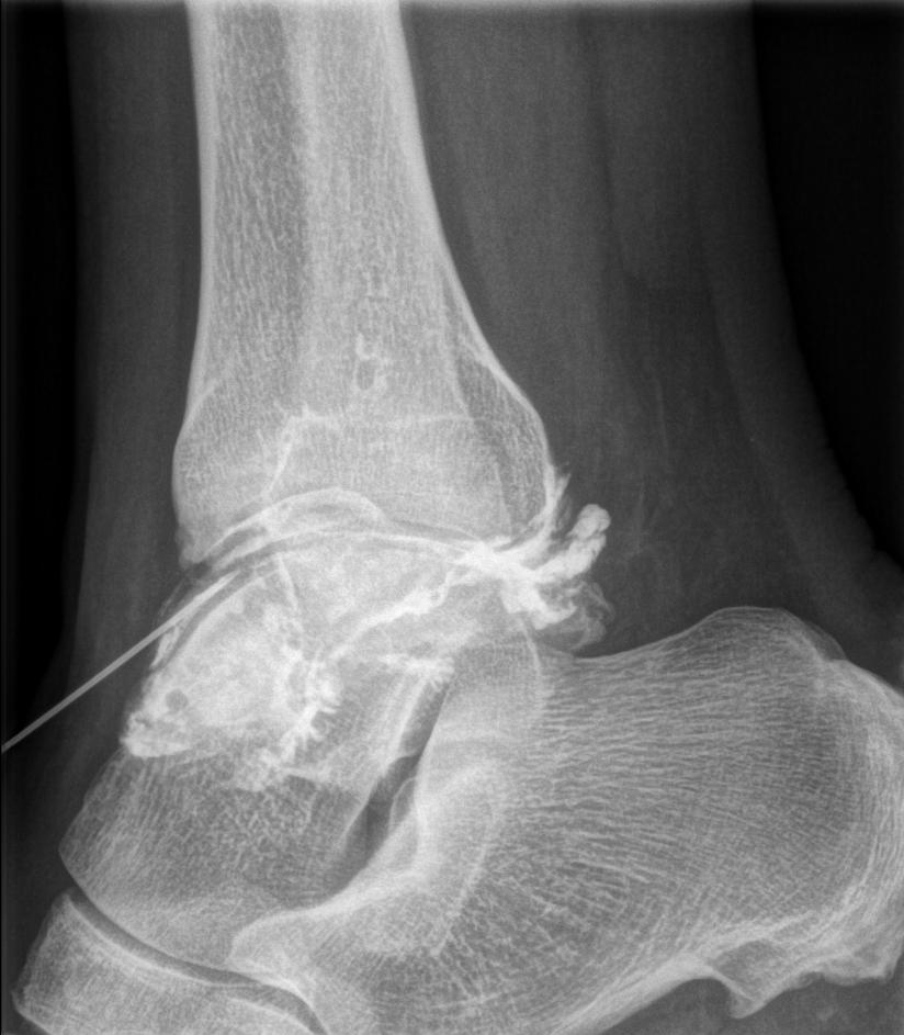 radiographie_interventionnelle